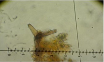 Digitatispora lignícola