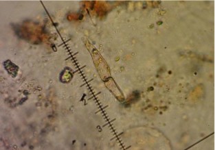 Halosphaeria cucullata