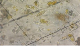 Helicomyces roseus (agua dulce)