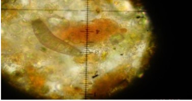 Koralionastes ellipticus