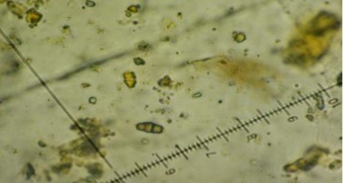 Leptosphaeria oraemaris