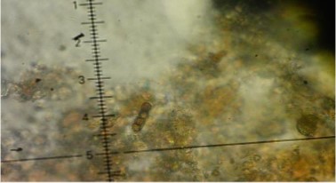 Leptosphaeria oraemaris