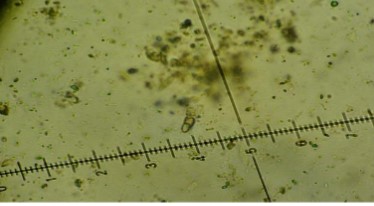 Mycosphaerella salicorniae