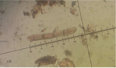Orcadia ascophylli