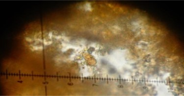 Paraliomyces lentiferus