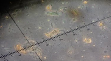 Pestaliotopsis sp