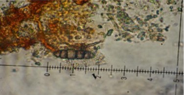 Phaeosphaeria spartinae