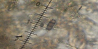 Pithomyces sp