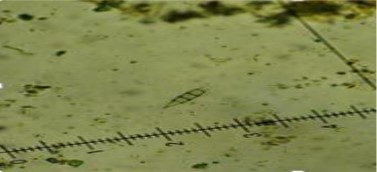Pithomyces terricola  

 
