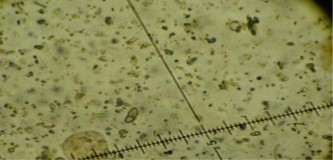 Arthopyrenia halodytes