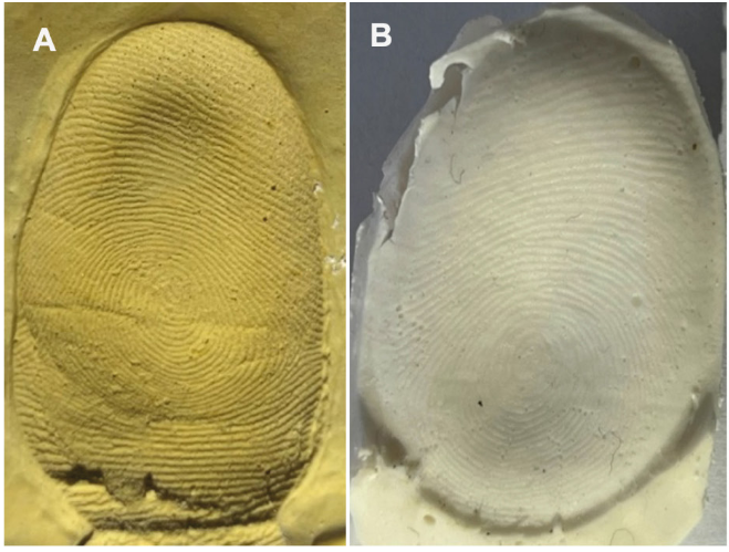 Morfolog&iacute;a de las r&eacute;plicas de la huella (A) Molde de yeso odontol&oacute;gico y (B) R&eacute;plica de huellas en alginato.