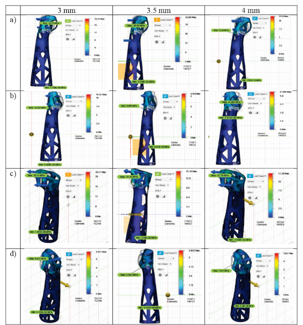 Figura 6. Esfuerzos
obtenidos de ortesis mediante optimización topológica con espesores de 3, 3.5 y
4 mm respectivamente, para: a) Flexión b) Extensión c) Abducción d) Aducción.



