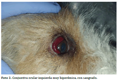 Foto 2. Conjuntiva ocular
izquierda muy hiperémica, con sangrado