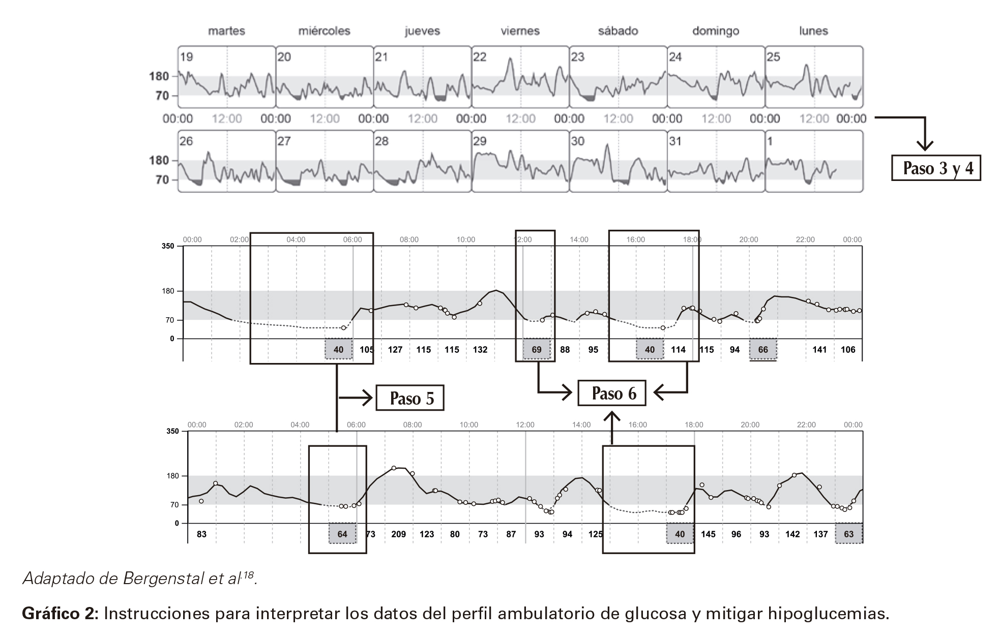 Instrucciones para interpretar los datos del perfil ambulatorio de glucosa y mitigar hipoglucemias.