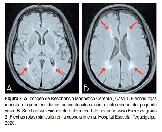 Figura 2