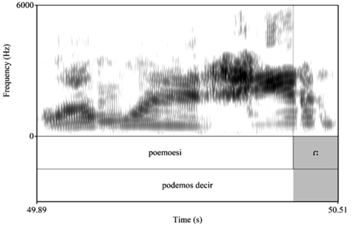 Espectrograma
de la frase podemos decir en la MD_01