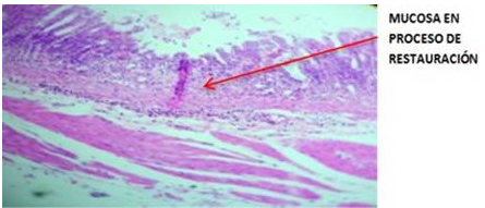  Zona antropilórica del estómago
(agrupación 2) donde se observa una mucosa necrosada con atrofia

glándular.