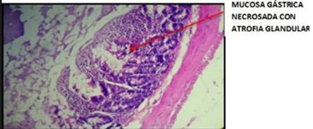 Zona del cuerpo
del estómago (agrupación 5) observándose células epiteliales de mucosa sana
migrando hacia la zona de injuria para restaurar la lesión de la mucosa