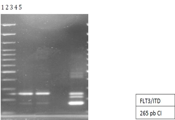 Gel de agarosa, donde se observa los productos de
amplificación por RT-PCR para la mutación FLT3/ITD en 2 pacientes
(carriles 2,3); control negativo (carril 4); control positivo FLT3/ITD (carril
5). La banda inferior corresponde al gen normal y la banda superior al gen FLT3
mutado. Las muestras fueron corridas en un gel de agarosa al 2% teñido con
bromuro de etidio; en el carril 1 se utilizó un marcador de peso molecular de
100pb.

 