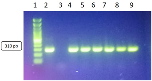 Productos de PCR del gen mecA con un amplicón de 310 pb. Carriles: 1 escalera alélica, 2 control positivo, 3 control negativo 4, 5, 6, 7,8 y 9 cepas positivas