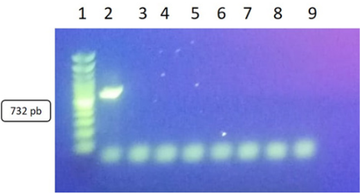Productos de PCR del gen vanA con un amplicón de 732 pb. Carriles: 1 escalera alélica, 2 control positivo, 3 control negativo 4, 5, 6, 7,8 y 9 cepas negativas