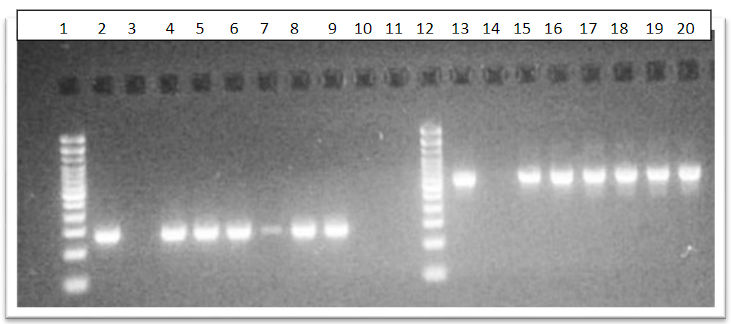Productos de PCR para el gen nucA (270pb) y femB (651
pb) de S. aureus aislados de las superficies hospitalarias, carril 1:
marcador de Peso Molecular (PM); carril 2 cepa control positivo; carriles 3
cepa control negativo; carriles 4, 5, 6, 7, 8,9 cepas positivas de nucA. Carril
12: ,marcador de PM, carriel 13: cepa control positivo, carril 14 cepa control
negativo, carriles 15,16,17,18,19,20 cepas positivas para femB