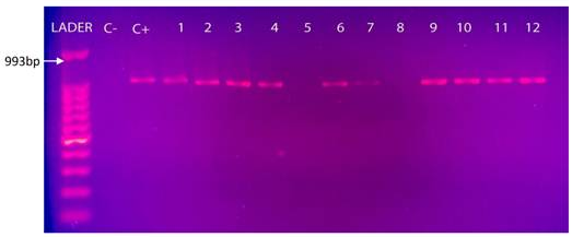 Electroforesis en gel de agarosa al 1,5% de la amplificación por
PCR del gen 23S ARNr.
