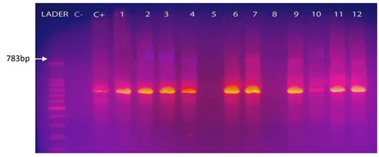 Electroforesis en gel de agarosa al 1,5% de la amplificación por
Seminested PCR del gen 23S ARNr