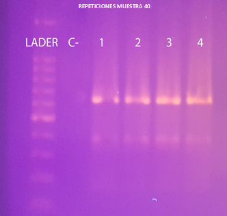 Electroforesis en gel de agarosa al 1,5% del RFLP con la enzima
de restricción HhaI