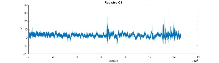  Registro de
Electroencefalograma (EEG) de la región central izquierda (C3).