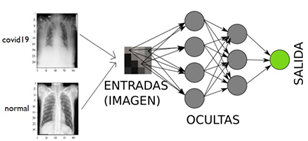  Arquitectura
del modelo A