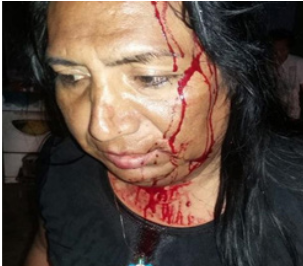 Yefri Peña Tuanama
activista LGTBI sufrió grave agresión por su orientación sexual.