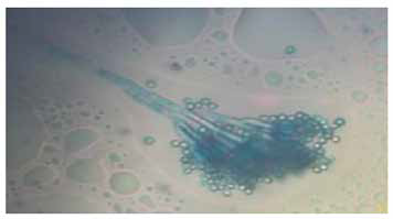 Morfolog&iacute;a de Penicillium spp