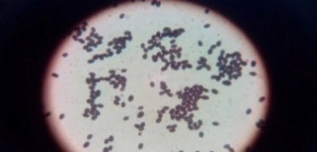  Esporas de Coprinuscomatus a 40X.