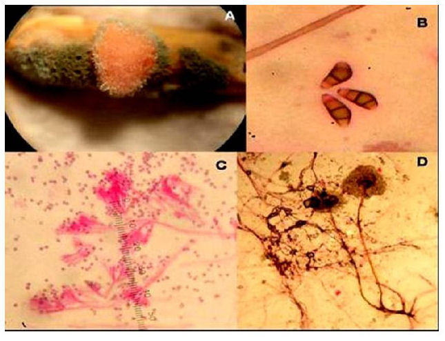 A. Semilla de arroz con desarrollo fúngico. B. Conidios de Curvularia
 sp. C. Estructuras conidiales de Penicillium sp. D. Estructuras de Rhizopus sp., desarrollados sobre semillas de arroz tratadas con
propóleos
