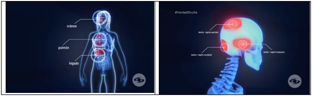 
 
  
  Imágenes 1 y 2.
  Representación general de lesiones en el cuerpo de la víctima4