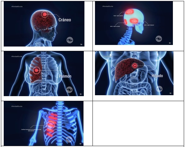 Imágenes 3, 4, 5, 6 y 7. Representación
específica de lesiones en el cuerpo de la víctima