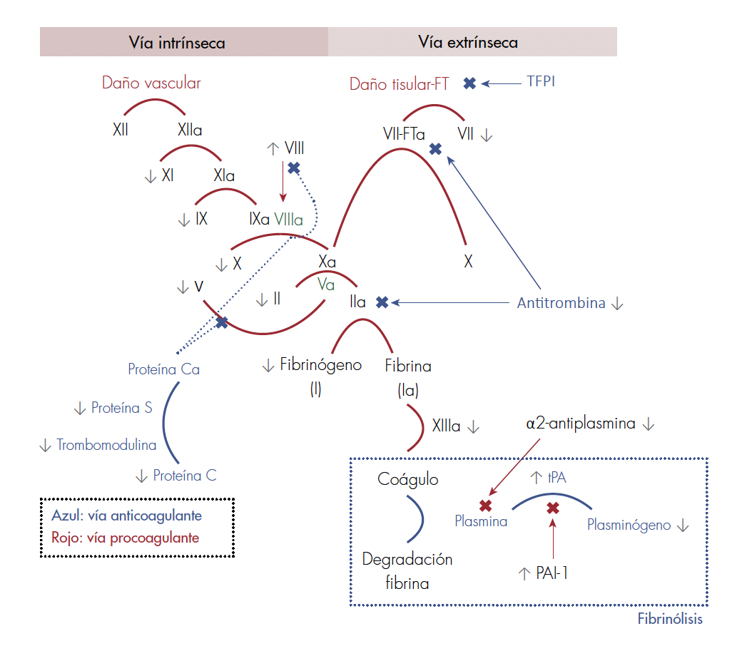 Cambios en la cascada de la coagulación en el paciente cirrótico. FT: factor tisular; TFPI: inhibidor de la vía del factor tisular; II: protrombina; IIa: trombina; tPA: activador tisular del plasminógeno; PAI-1: inhibidor del activador tisular del plasminógeno. Tomado y adaptado [15].